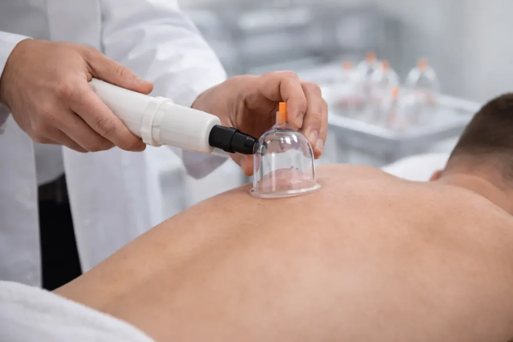 Doktor gözetiminde yapılan kupa terapisi ve uygulamalı tıbbi hacamat dersi